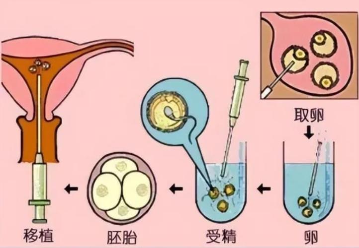 供卵试管宝宝老是哭闹什么原因